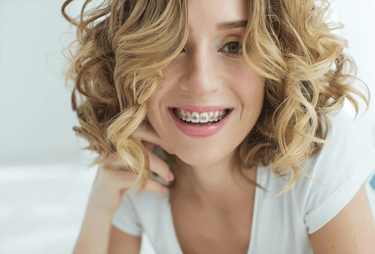 clear braces and traditional braces