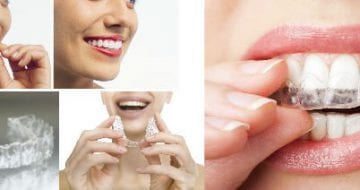 How to take care of your braces