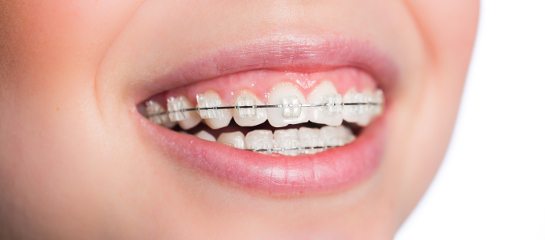 best age for orthodontic treatment