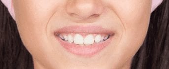 Is there such thing as the perfect bite?