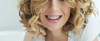 clear braces and traditional braces
