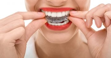 What Invisalign Can Fix!